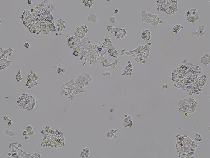 Brightfield micrograph of H520, showing adherent growth.