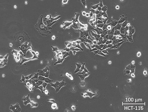 Brightfield micrograph of HCT-116, showing adherent growth.