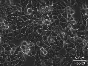 Brightfield micrograph of HEC-59, showing adherent growth.