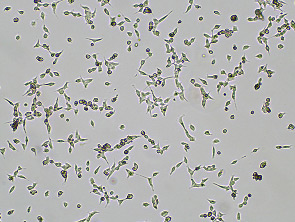 Brightfield micrograph of HEK293-hSYVN1-1D3, adherent growth, 4X mag.