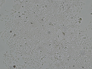 Brightfield micrograph of Hep-3B2.1-7, showing adherent growth.