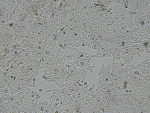 Brightfield micrograph of HGC-27, showing adherent growth.