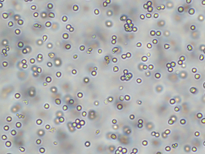 Brightfield micrograph of HL-60, showing suspension growth, 10X magnification.