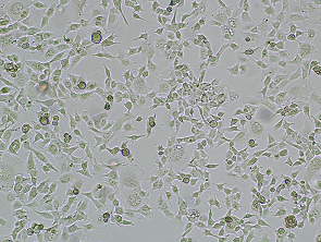 Brightfield micrograph of HS 746T, adherent growth, 4X mag.