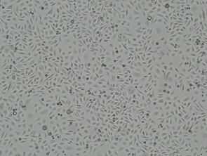 Brightfield micrograph of HSC-3, showing adherent growth.