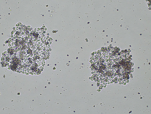 Brightfield micrograph of HT-115, showing adherent growth, 4X magnification.