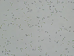 Brightfield micrograph of HT-55, adherent growth, 4X mag.