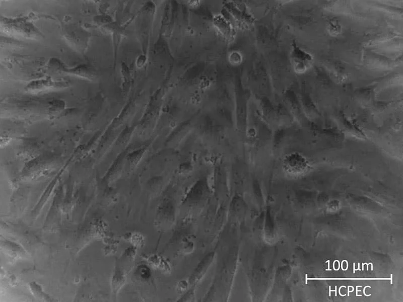 HUMAN CHOROID