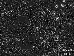 Brightfield micrograph of HeLa, showing adherent growth.