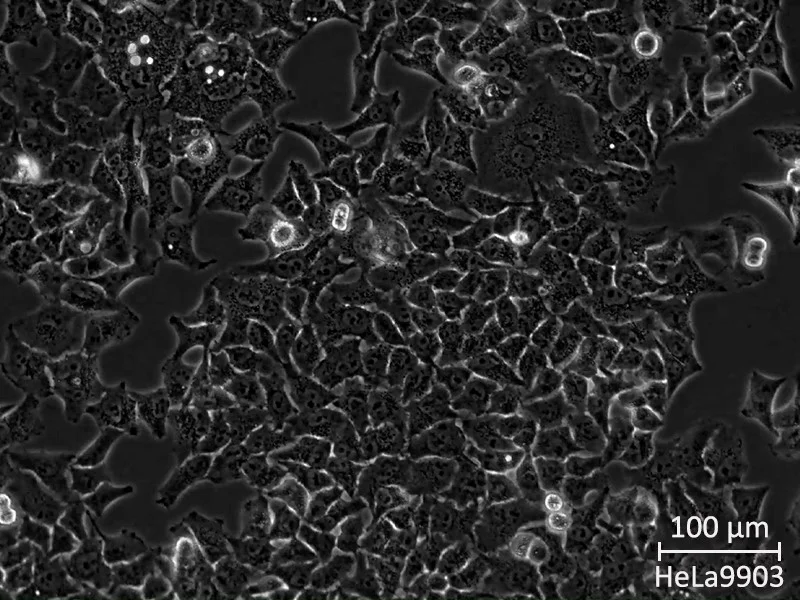 HeLa9903