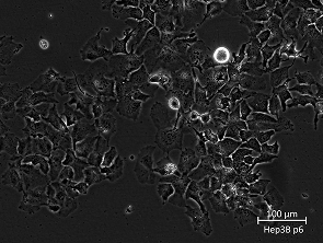 Brightfield micrograph of Hep 3B, adherent growth, 20X mag.