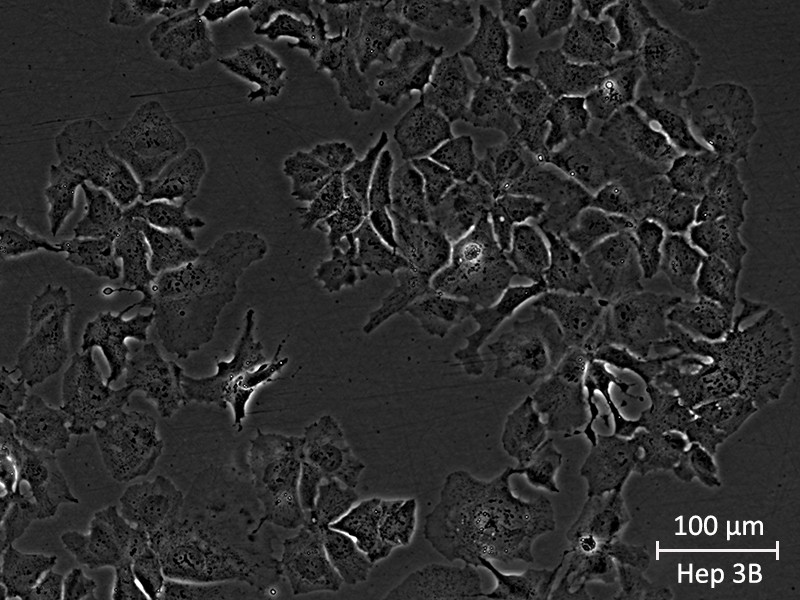 Brightfield micrograph of Hep 3B, showing adherent growth, 20X magnification.