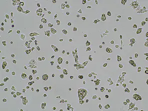 Brightfield micrograph of HepG2, adherent growth, 4X mag.