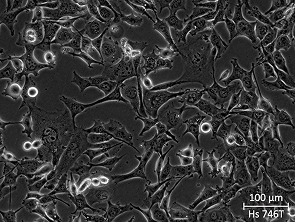 Brightfield micrograph of Hs 746T, showing adherent growth, 20X magnification.