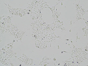 Brightfield micrograph of HuP-T3, showing adherent growth.