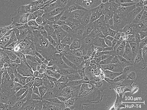 Brightfield micrograph of HuP-T4, showing adherent growth.