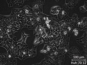 Brightfield micrograph of Huh-7D 12, showing adherent growth.