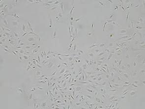 Brightfield micrograph of Human Brain Microvascular Endothelial Cells, showing adherent growth, 4X magnification.