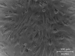 Brightfield micrograph of Human Choroid Plexus Epithelial Cells, showing adherent growth.