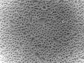 Brightfield micrograph of Human Epidermal Keratinocytes, Adult, showing adherent growth, 10X magnification.