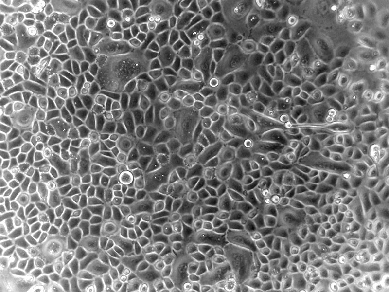 Brightfield micrograph of Human Oral Keratinocytes, showing adherent growth, 10X magnification.