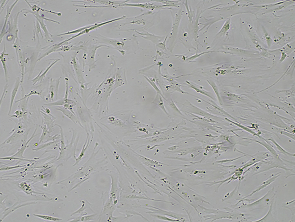 Brightfield micrograph of IMR-90, adherent growth, 4X mag.