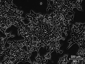 Brightfield micrograph of INS-1, showing adherent growth, 20X magnification.