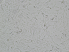 Brightfield micrograph of Immortalized-Human-Endometriotic-Cell-Line, adherent growth, 4X mag.
