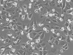 Brightfield micrograph of Immortalized Human Hepatocytes, showing adherent growth.