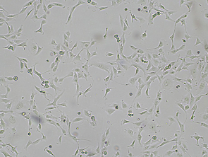 Brightfield micrograph of Immortalized Human Renal Proximal Tubule Cell Line, adherent growth, 4X mag.
