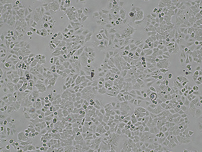 Brightfield micrograph of Ishikawa, showing adherent growth.