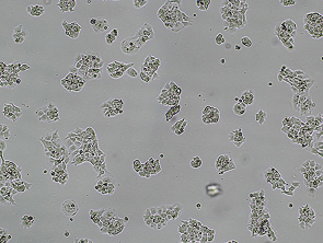 Brightfield micrograph of JAR, showing adherent growth.