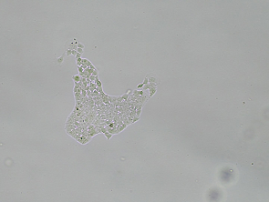Brightfield micrograph of JHH-7, showing adherent growth, 4X magnification.