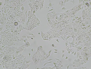 Brightfield micrograph of JHUEM-3, showing adherent growth, 4X magnification.
