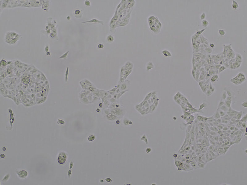 Brightfield micrograph of JHUEM-3, showing adherent growth, 4X magnification.