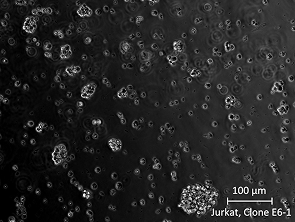 Brightfield micrograph of Jurkat, Clone E6-1, showing suspension growth, 20X magnification.