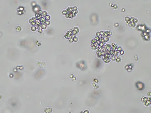Brightfield micrograph of K-562, showing suspension growth, 10X magnification.