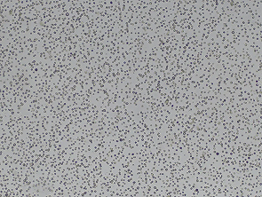 Brightfield micrograph of K-562, showing suspension growth.