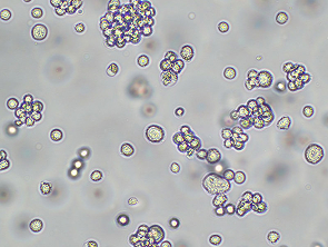 Brightfield micrograph of K562/ADM, showing suspension growth, 10X magnification.