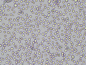 Brightfield micrograph of KARPAS 299, showing suspension growth, 10X magnification.