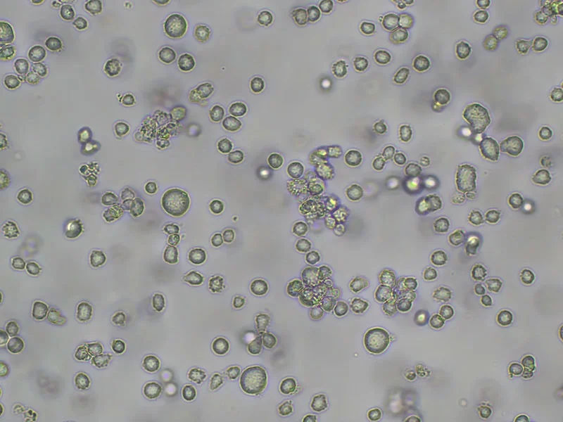 Brightfield micrograph of KARPAS 299, showing suspension growth, 10X magnification.