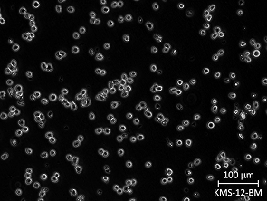 Brightfield micrograph of KMS-12-BM, showing suspension growth, 20X magnification.