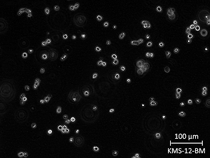 Brightfield micrograph of KMS-12-BM, showing suspension growth, 20X magnification.