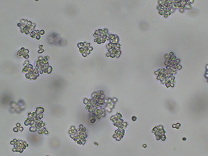 Brightfield micrograph of KMS-20, showing suspension growth.