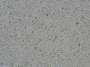 Brightfield micrograph of KNS-42, showing adherent growth.