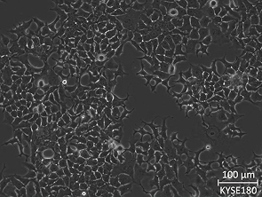 Brightfield micrograph of KYSE180, showing adherent growth.