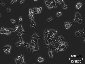 Brightfield micrograph of KYSE70, showing adherent growth.