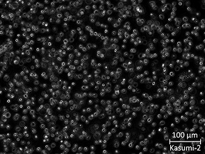 Brightfield micrograph of Kasumi-2, showing suspension growth.