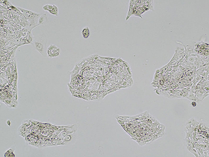 Brightfield micrograph of LCLC-97TM1, showing adherent growth.