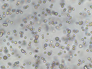 Brightfield micrograph of LP-1, showing suspension growth, 10X magnification.
